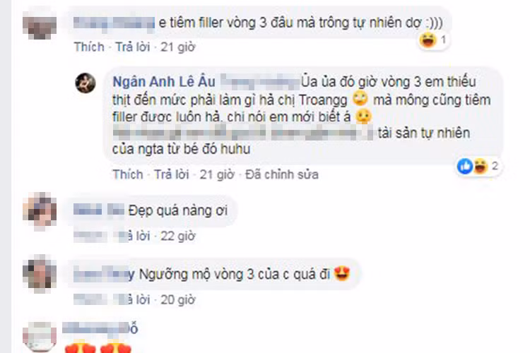 Một cư dân mạng nghi ngờ Ngân Anh tiêm filler để sở hữu vòng ba gợi cảm. Trước nghi vấn này, Ngân Anh đáp trả: "Vòng ba em thiếu thịt đến mức phải làm gì hả chị, mà mông cũng tiêm filler được luôn hả, chị nói em mới biết".