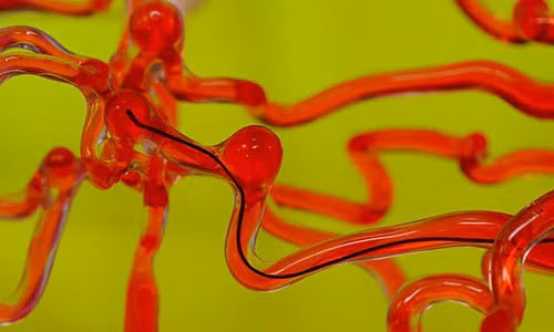 Robot mong nhu con giun, ‘bo’ trong nao de pha cuc mau dong