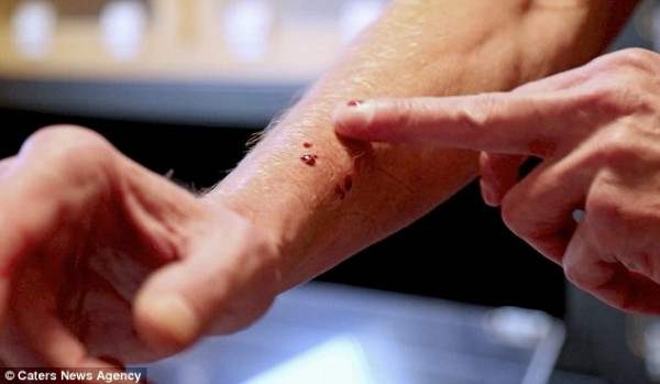 Thông thường, một vết cắn từ loài rắn cực độc Mamba Đen có thể khiến con người chết trong đau đớn trong 15 phút nhưng đối với Tim thì đó chỉ là chuyện nhỏ.