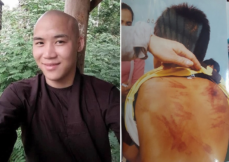 Giam dinh thuong tat chau be to thay tu danh dap, xam hai tinh duc