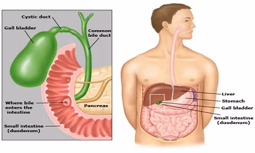 5. Giúp ngăn ngừa sỏi mật Cây kế sữa giúp hỗ trợ các nội tiết và hệ thống tiêu hóa trong việc sản xuất mật và các enzym, giúp làm sạch máu, đồng thời có thể giúp thanh lọc cơ thể, từ đó điều chỉnh các chức năng của túi mật, ngoài thận và lá lách giúp ngăn ngừa sỏi mật và sỏi thận. (Ảnh: Draxe)