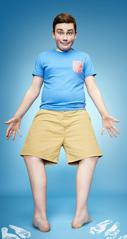 Góc quay chân lớn nhất thế giới thuộc về chàng trai Maxwell người Anh 17 tuổi, cậu có thể xoay bàn chân với góc 157 °.