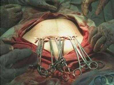 Cai ket dang cua san phu 40 tuoi luoi kham thai-Hinh-2