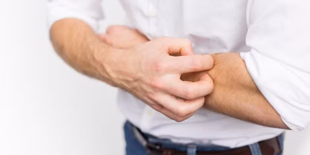 Bất cứ ai bị mụn nhọt và mẩn ngứa ngoài da nếu biết dùng hoa dã quỳ đúng cách sẽ khỏi bệnh. Ảnh: Genk.