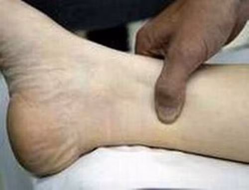 Thực hiện đều đặn động tác này sẽ giúp cơ thể bạn có những biến đổi bất ngờ. Tác dụng chính của vị trí huyệt đạo này là giữ sức khỏe và kiểm soát sự thèm ăn của bạn một cách vô cùng hiệu quả.