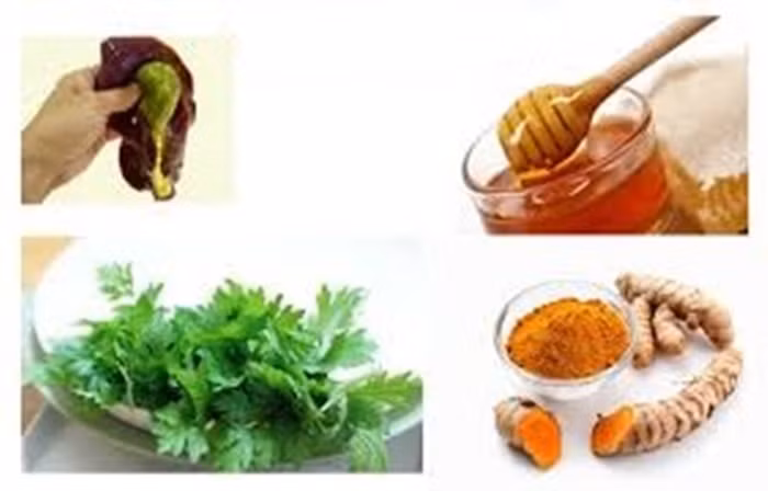 Rau ngải cứu. Nghệ tươi và ngải cứu rửa sạch, cắt nhỏ xay nhuyễn cùng với 0,5 lít nước sau đó lọc lấy nước. Mật lợn lọc lấy nước. Cho tất cả hai loại nước này vào nồi đun nhỏ lửa để cô lại thành cao rồi nặn thành viên như hạt lạc. Cho phần cao đó vào một cái lọ bảo quản trong ngăn mát tủ lạnh để dùng dần. Mỗi ngày uống 1 viên trước bữa ăn 30 phút sáng và tối. Ảnh: Yduocphuongdong. (Thông tin trong bài viết chỉ mang tính chất tham khảo. Trước khi sử dụng bài thuốc, bạn vui lòng hỏi ý kiến bác sĩ).