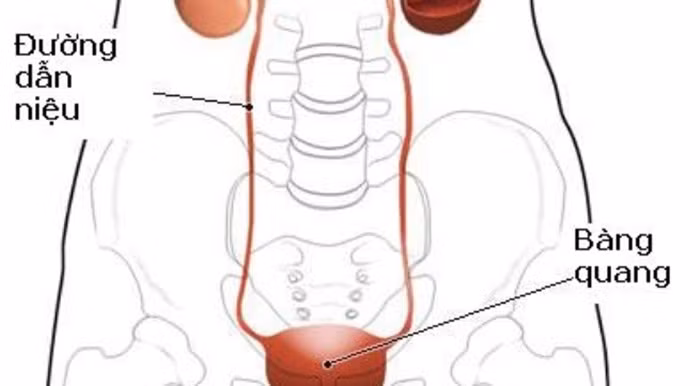 Viêm đường tiết niệu là bệnh viêm nhiễm do vi khuẩn. Nó không đe dọa đến cuộc sống của người bệnh nhưng lại gây đau rát và khó chịu. Để điều trị bệnh này, mọi người nghĩ ngay đến kháng sinh nhưng nếu không muốn có thể dùng đến liệu pháp dân gian, thảo dược tự nhiên. Ảnh: Suckhoecongdong.