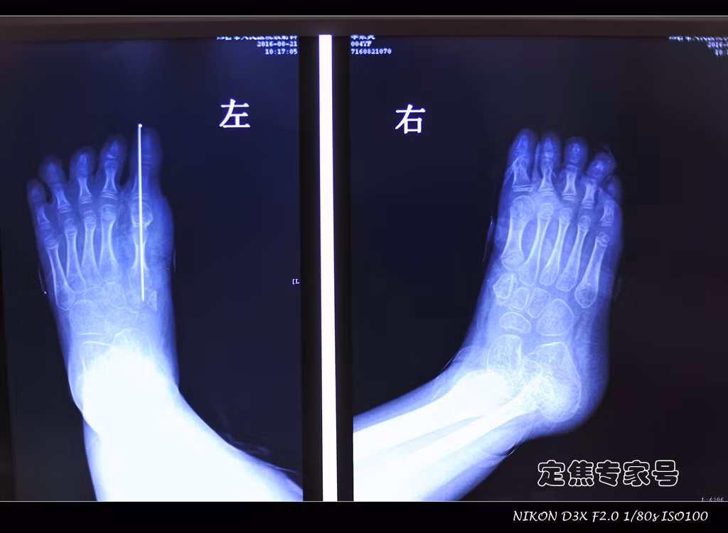 Các dây thần kinh động mạch cuối cùng đã được thông...