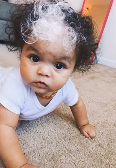 Mẹ bé hy vọng, với màu tóc và vết bớt này, cô bé lớn lên sẽ tự hào và trở nên đặc biệt hơn so với những người khác.