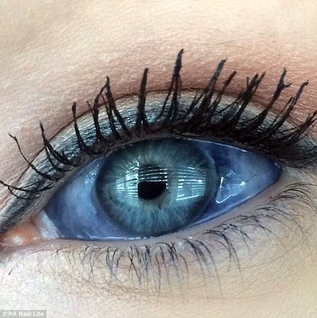 Cô Sara cho biết, trước đây màu mắt tự nhiên của cô là màu xanh đậm tự nhiên. Cô đọc tài liệu về những hình xăm nhãn cầu và nghĩ rằng nó thực sự thật tuyệt. Vì thế mà cô quyết định xăm màu mắt để có cái nhìn ma mị hơn.