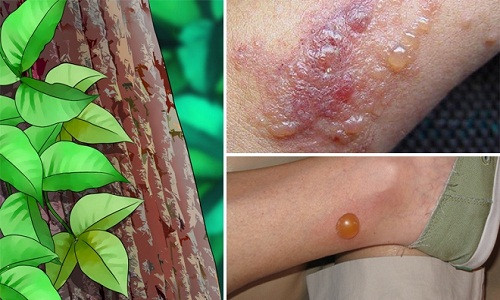 6. Chống nhiễm trùng. Ngoài tính chất kháng khuẩn, lá cây thường xuân chứa các chất chống ký sinh trùng, giúp loại bỏ giun đường ruột. Sử dụng lá cây thường xuân có thể giúp loại bỏ giun ra khỏi ruột của bạn. Dùng lá thường xuân nấu nước gội đầu có thể loại bỏ được chấy rận trên tóc.