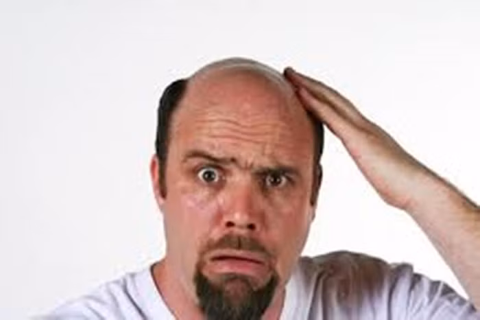 Dễ bị bệnh tim mạch. Tạp chí Y học Anh năm 2013 đã đăng kết quả nghiên cứu rằng, những đàn ông mắc chứng rụng tóc và hói đầu có nguy cơ bị bệnh tim cao hơn 32% so với người khác. Tuy rằng, bất kỳ giải thích nào cho sự liên quan này hiện cũng khá mù mờ. Ảnh: Chuyenkhoanamhoc.