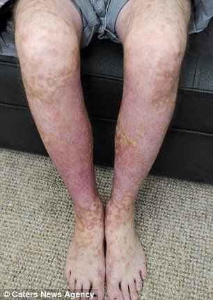 Trai tre tu thieu song co the do dung sai thuoc-Hinh-3