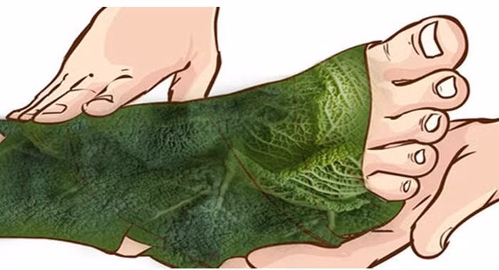 Giảm đau nhức. Để giảm những cơn đau nhức xương vào thời điểm giao mùa, đau phong thấp, đau thần kinh tọa... bạn có thể uống nước ép bắp cải xoăn sống và lấy bã đắp vào vùng bị đau nhức. Ảnh: Lamcongai. (Thông tin trong bài chỉ mang tính chất tham khảo, trước khi sử dụng bài thuốc, bạn vui lòng hỏi ý kiến bác sĩ).