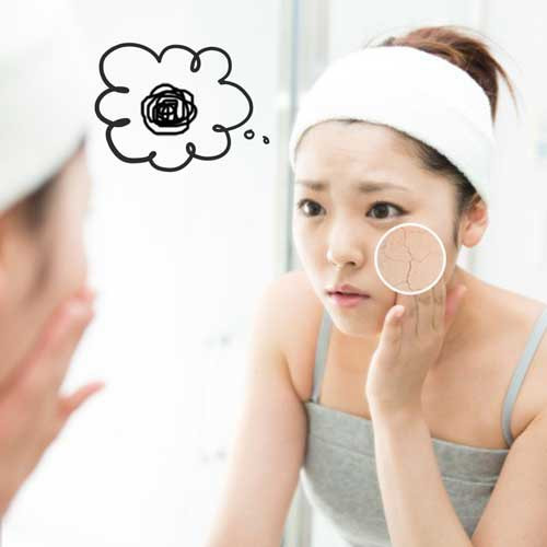 Da khô và nứt nẻ: Vitamin C giúp bảo vệ da khỏi các tổn thương do ánh nắng mặt trời; đồng thời duy trì làn da trẻ trung và đàn hồi. Do đó, thiếu vitamin C đồng nghĩa với làn da khô và nứt nẻ. (Ảnh: Internet)