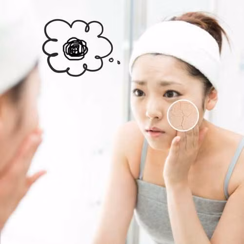 Da khô và nứt nẻ: Vitamin C giúp bảo vệ da khỏi các tổn thương do ánh nắng mặt trời; đồng thời duy trì làn da trẻ trung và đàn hồi. Do đó, thiếu vitamin C đồng nghĩa với làn da khô và nứt nẻ. (Ảnh: Internet)