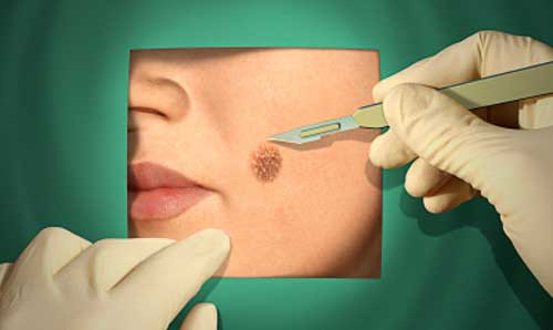 Tay not ruoi bang hoa chat