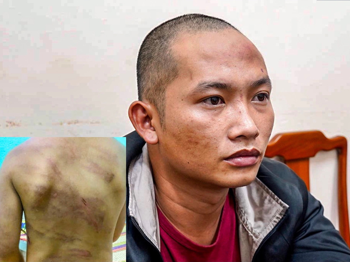 Tin nong 29/7: Nguoi phu nu bi chong cu tat nuoc soi-Hinh-2