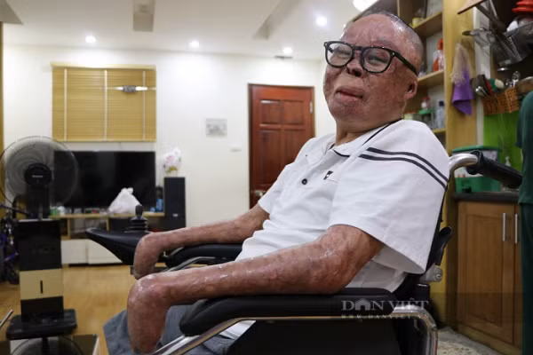 Cuoc song cua chien si duy nhat song sot sau vu truc thang roi o Hoa Lac