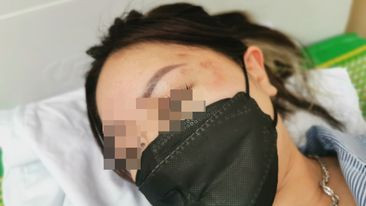  Điều tra vụ cô gái tố bị sàm sỡ, hành hung ở Aeon Mall Long Biên: Theo đơn tố cáo của nạn nhân, chị A. trình bày tối 16/7, chị cùng bạn đi mua sắm tại trung tâm thương mại Aeon Mall Long Biên. Khoảng 20h, chị đứng ở cổng số 2, thì bị H. sàm sỡ, đụng chạm vào vùng nhạy cảm. Cô gái 24 tuổi sau đó phản ứng, chất vấn lại người đàn ông, thì bị anh ta hành hung, đánh nhiều phát vào đầu. Chị A. cũng cho biết thời điểm đó, H. phủ nhận hành vi sàm sỡ chị.