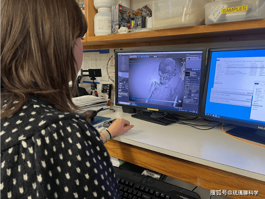 Chế độ ăn của bà gồm ngũ cốc, trái cây và cá, nhưng răng bị mòn do sử dụng cối xay đá trong chế biến thực phẩm.(Ảnh: thanhnienviet.vn)