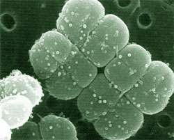Deinococcus radiodurans, biệt danh "Vi khuẩn Conan", là loài vi khuẩn chịu bức xạ mạnh nhất trên Trái Đất, sống sót trong môi trường bức xạ cao gấp hàng nghìn lần mức con người chịu đựng. (Ảnh: European Synchrotron Radiation Facility)
