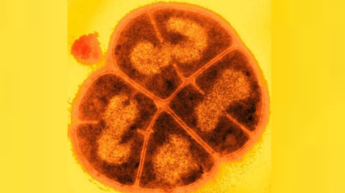 Bí quyết sinh tồn của vi khuẩn này là MDP, một chất chống oxy hóa gồm ion mangan, phốt phát và peptide tổng hợp, giúp bảo vệ protein khỏi tổn thương bức xạ.(Ảnh: the Astrobiology Web)