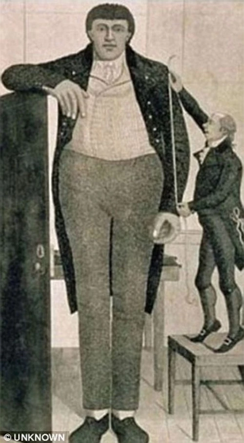 Trường hợp nổi tiếng là Charles Byrne ở thế kỷ 18, cao gần 2,5m và qua đời ở tuổi 22 vì hệ quả của gene đột biến. (Ảnh: DNVN)