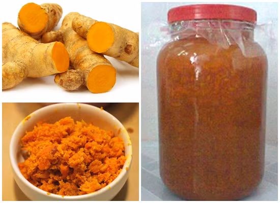 Rượu nghệ. Một trong những thực phẩm trị nám rẻ mà hiệu quả nhất là nghệ. Nghệ giàu tinh bột và tinh dầu, đặc biệt là thành phần curcuma longa có tác dụng kháng viêm, sát khuẩn, sát trùng và trị nám hiệu quả. Bạn có thể dùng tinh nghệ ngâm với rượu trong 3 ngày và bôi lên các vết nám một giờ đồng hồ rồi rửa sạch. Ảnh: Trinamda.