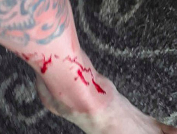 Trong lúc câu thấy cần nặng, White kéo lên và phát hiện một con cá mập đã đớp mồi. Anh cúi xuống gỡ móc câu thì bị con cá mập lao tới cắn mạnh. White la lớn để tìm sự giúp đỡ.