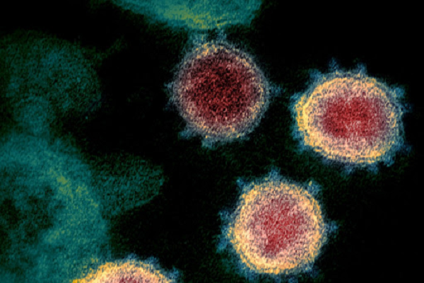 “Bởi vậy, nếu chúng ta cho phép virus tự do lưu hành và không cố gắng ngăn chặn nó thì sớm muộn gì biến thể mới cũng sẽ xuất hiện. Dù không chắc chắn, nhưng biến thể mới có thể sẽ nguy hiểm hơn biến thể Delta”, ông Fauci nói.