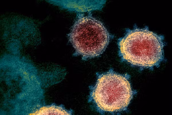 “Bởi vậy, nếu chúng ta cho phép virus tự do lưu hành và không cố gắng ngăn chặn nó thì sớm muộn gì biến thể mới cũng sẽ xuất hiện. Dù không chắc chắn, nhưng biến thể mới có thể sẽ nguy hiểm hơn biến thể Delta”, ông Fauci nói.