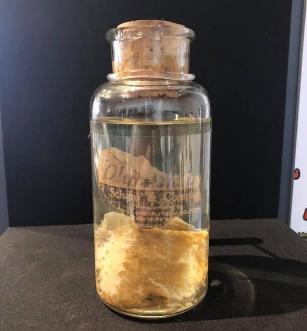 Bên cạnh đó, nhiều người cho rằng thịt bị nôn ra bởi một đàn kền kền bay ngang qua. Tuy nhiên để nôn ra số thịt nhiều như vậy phải cần rất nhiều kền kền mà lúc đó không có gì trên bầu trời. Mọi chuyện chìm vào quên lãng và đến nay nó vẫn là một bí ẩn lớn không có lời giải. Mời các bạn xem video: Khung cảnh thiên nhiên tuyệt đẹp tại các quốc gia ít dân nhất thế giới. 