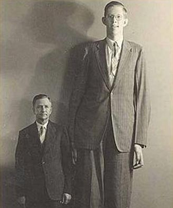 Theo như mô tả thì những bộ hài cốt này có xương phía hốc mắt và mũi cao hơn xương gò má, xương hàm lại có sự tương đồng với loài khỉ. Nhiều giả thiết cho rằng, đây là bằng chứng hùng hồn chứng minh sự tồn tại của người khổng lồ là có thật.