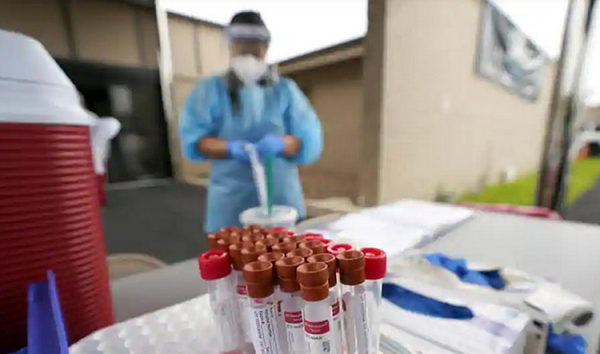 Các nhà nghiên cứu hy vọng có thể thiết kế thiết bị chẩn đoán cho kết quả nhanh chóng và dễ hoạt động. Bên cạnh đó, việc thiết bị hoạt động với mẫu nước bọt giúp người dùng dễ thao tác hơn.