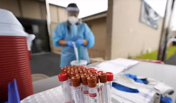 Các nhà nghiên cứu hy vọng có thể thiết kế thiết bị chẩn đoán cho kết quả nhanh chóng và dễ hoạt động. Bên cạnh đó, việc thiết bị hoạt động với mẫu nước bọt giúp người dùng dễ thao tác hơn.