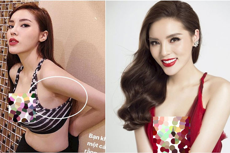 Kỳ Duyên thừa nhận nâng ngực vào tháng 3/2018. Ảnh: Thế giới trẻ