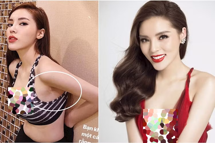 Kỳ Duyên thừa nhận nâng ngực vào tháng 3/2018. Ảnh: Thế giới trẻ