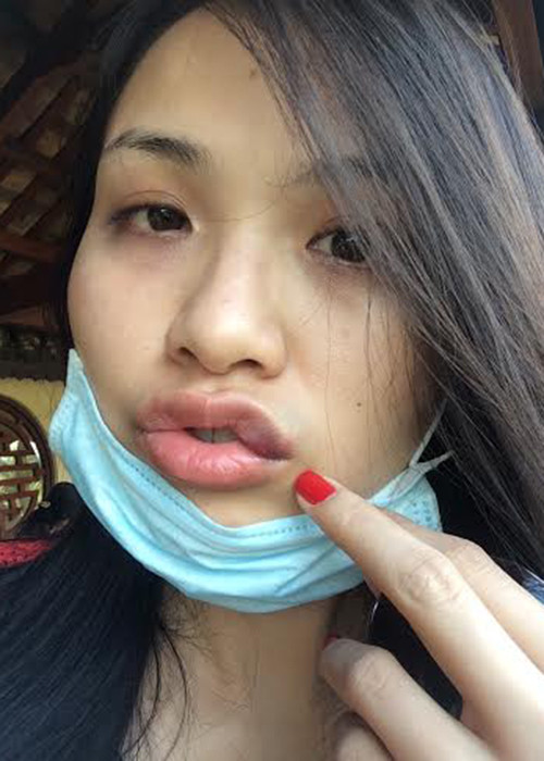 Trong đơn tố cáo, Diễm Hương kể cô bị chồng cũ đánh không thương tiếc đến 3 lần, trong đó 2 lần là vì ghen tuông vô cớ. Ảnh: Người lao động