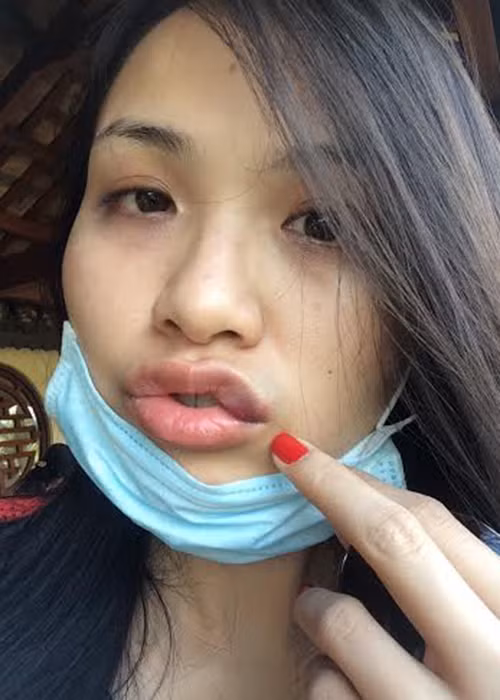 Trong đơn tố cáo, Diễm Hương kể cô bị chồng cũ đánh không thương tiếc đến 3 lần, trong đó 2 lần là vì ghen tuông vô cớ. Ảnh: Người lao động