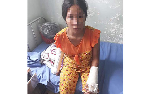 Them vu chong danh vo: Dung gay danh vo so, gay nhieu xuong vo dang bau