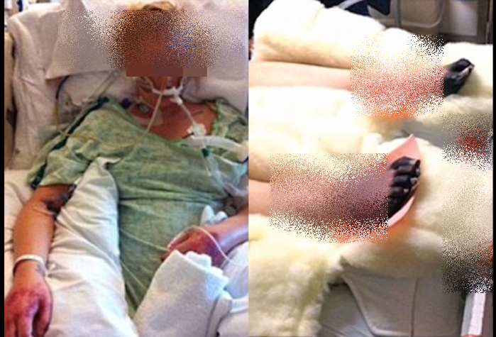 Nguy co mac phai hoi chung soc nhiem doc nguy hiem khi den “ngay den do