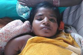 Bây giờ, khi bệnh đã phát triển mạnh, tay và chân của Kunti bắt đầu co lại, bị uốn cong như hình chữ S. Cả mẹ và cô gái trẻ vẫn đang hy vọng có một phép màu xảy ra để cô có thể đi lại như người bình thường.