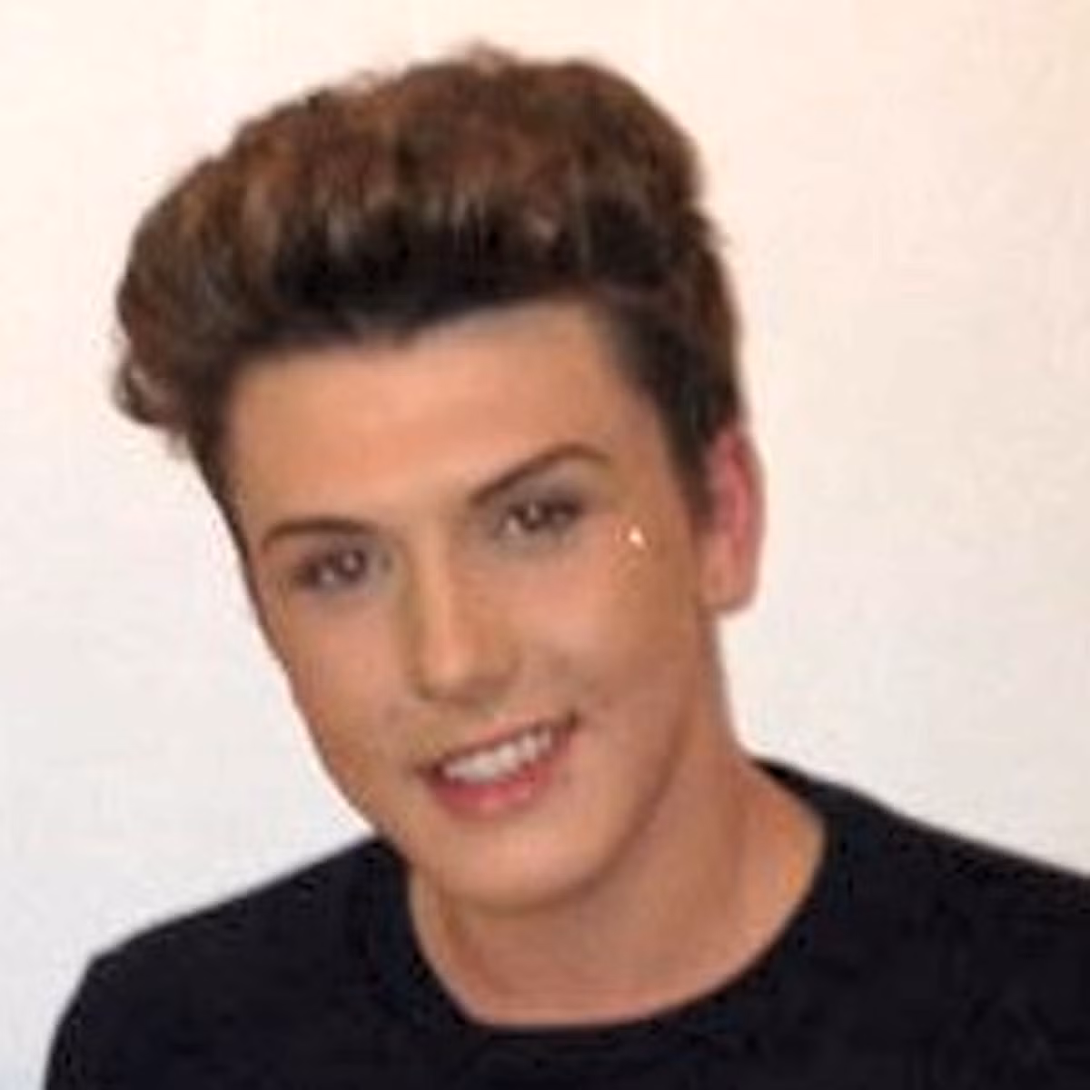 Anh James Holt, 22 tuổi đã có ca phẫu thuật thẩm mỹ đầu tiên của mình vào lúc 17 tuổi và bây giờ, anh trở thành nghiện thẩm mỹ.