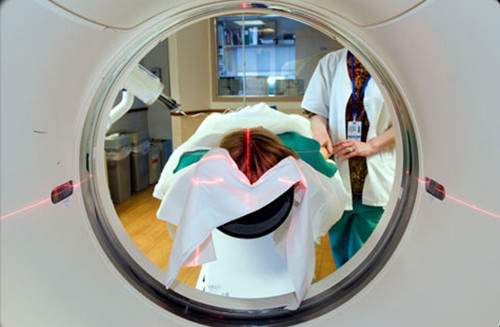 Tuy nhiên, xạ trị ung thư não có thể sẽ ảnh hưởng nặng hơn bởi đặc thù của vùng điều trị. Nó có thể có những tác dụng phụ gây khó chịu cho người bệnh.