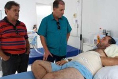 Trong một lần tai nạn lao động ở nhà máy thép mà bàn tay của anh đã bị ngiến nát da trên tay. Anh bị chấn thương nặng, da và mu bàn tay hầu như bị nát để lộ ra phần xương và dây chằng bên trong.