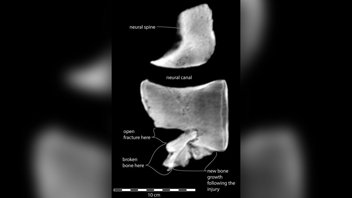 Godfrey nghi ngờ rằng, anh ấy có thể tìm hiểu thêm bằng cách nhìn vào bên trong đốt sống bị tổn thương với chụp CT và một bệnh viện địa phương đã đề nghị giúp đánh giá hóa thạch bằng các kỹ thuật hình ảnh y tế hiện đại.