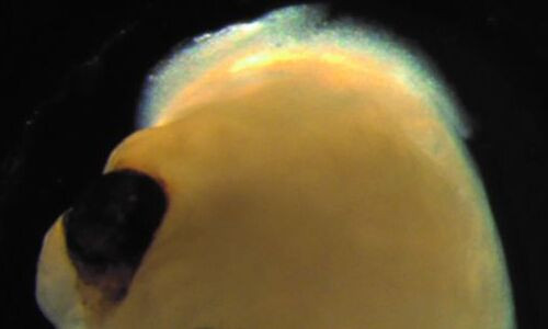 Vào tháng 8/2021, một nhóm các nhà khoa học đã nuôi cấy thành công một bộ não nhỏ bé với đôi mắt của chính nó trong phòng thí nghiệm. Họ đã tạo ra bộ não mini Cronenberg-esque, bằng cách biến đổi tế bào gốc thành mô thần kinh, sau đó kích thích tế bào bằng các tín hiệu hóa học để tạo hình khối dạng bộ não chứa đầy các tế bào nhạy cảm với ánh sáng.