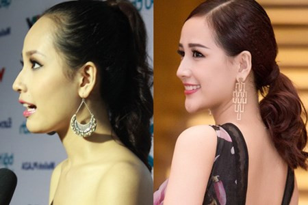 Nhung lan Mai Phuong Thuy bi nghi bom nguc, don cam-Hinh-7