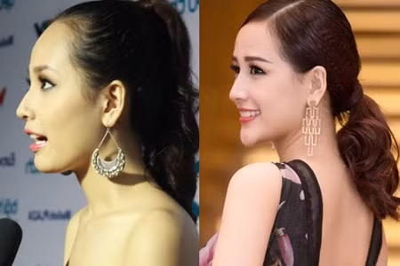 Nhung lan Mai Phuong Thuy bi nghi bom nguc, don cam-Hinh-7